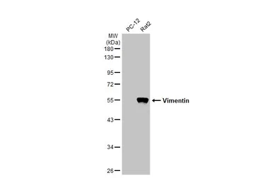 Anti-Vimentin antibody used in Western Blot (WB). GTX100619