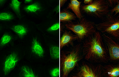 Anti-Vimentin antibody used in Immunocytochemistry/ Immunofluorescence (ICC/IF). GTX100619