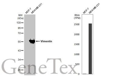 Anti-Vimentin antibody used in Western Blot (WB). GTX100619