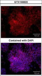 Anti-Oct4 antibody used in Immunocytochemistry/ Immunofluorescence (ICC/IF). GTX100622