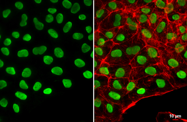 Anti-Oct4 antibody used in Immunocytochemistry/ Immunofluorescence (ICC/IF). GTX100622