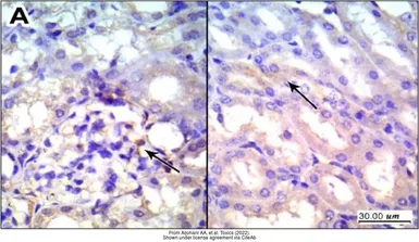 Anti-p53 antibody [N1], N-term used in IHC (Paraffin sections) (IHC-P). GTX100629