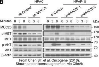 Anti-c-Met antibody [C3], C-term used in Western Blot (WB). GTX100637