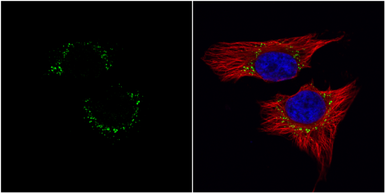 Anti-c-Met antibody [C3], C-term used in Immunocytochemistry/ Immunofluorescence (ICC/IF). GTX100637