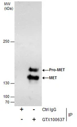 Anti-c-Met antibody [C3], C-term used in Immunoprecipitation (IP). GTX100637