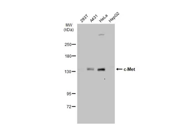 Anti-c-Met antibody [C3], C-term used in Western Blot (WB). GTX100637