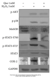 Anti-COX2 antibody [C3], C-term used in Western Blot (WB). GTX100656