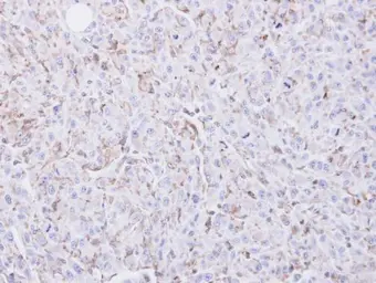 Anti-COX2 antibody [C3], C-term used in IHC (Paraffin sections) (IHC-P). GTX100656