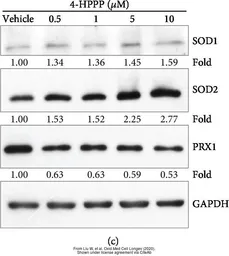 Anti-SOD1 antibody used in Western Blot (WB). GTX100659