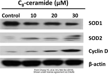 Anti-SOD1 antibody used in Western Blot (WB). GTX100659