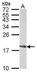 Anti-SOD1 antibody used in Western Blot (WB). GTX100659