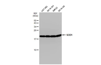 Anti-SOD1 antibody used in Western Blot (WB). GTX100659