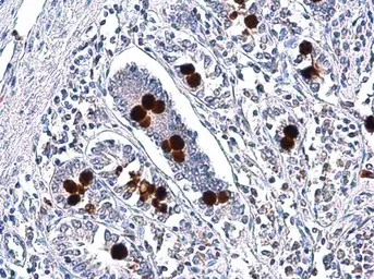 Anti-MUC2 antibody [C3], C-term used in IHC (Paraffin sections) (IHC-P). GTX100664