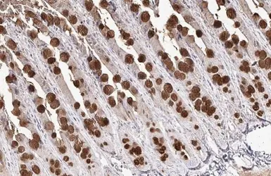 Anti-MUC2 antibody [C3], C-term used in IHC (Paraffin sections) (IHC-P). GTX100664