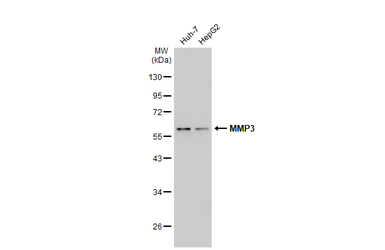 Anti-MMP3 antibody [N3C1], Internal used in Western Blot (WB). GTX100723