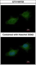 Anti-MMP3 antibody [N3C1], Internal used in Immunocytochemistry/ Immunofluorescence (ICC/IF). GTX100723