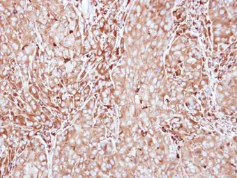 Anti-MMP3 antibody [N3C1], Internal used in IHC (Paraffin sections) (IHC-P). GTX100723