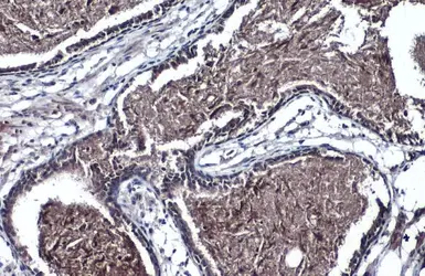 Anti-TMPRSS2 antibody [N2C3] used in IHC (Paraffin sections) (IHC-P). GTX100743