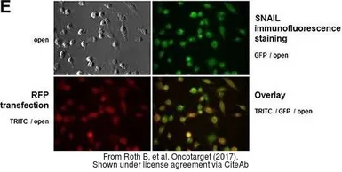 Anti-SNAI1 antibody used in Immunocytochemistry/ Immunofluorescence (ICC/IF). GTX100754