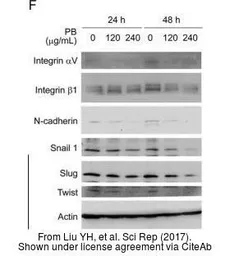 Anti-SNAI1 antibody used in Western Blot (WB). GTX100754