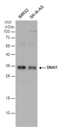 Anti-SNAI1 antibody used in Western Blot (WB). GTX100754