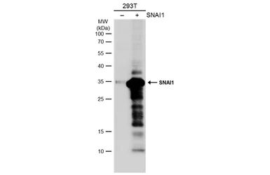 Anti-SNAI1 antibody used in Western Blot (WB). GTX100754