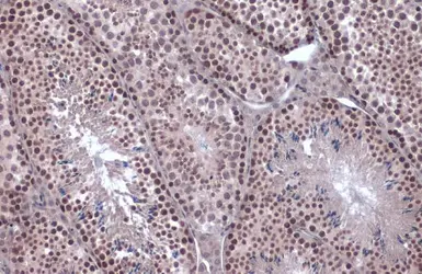 Anti-SNAI1 antibody used in IHC (Paraffin sections) (IHC-P). GTX100754