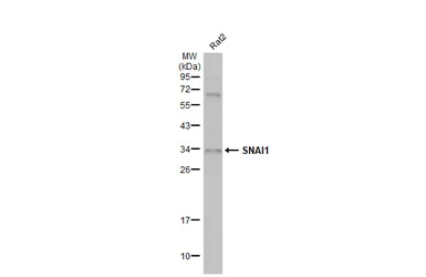 Anti-SNAI1 antibody used in Western Blot (WB). GTX100754