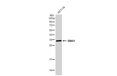 Anti-SNAI1 antibody used in Western Blot (WB). GTX100754