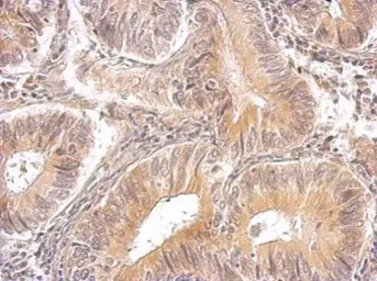 Anti-RRM1 antibody used in IHC (Paraffin sections) (IHC-P). GTX100758