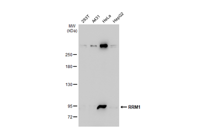 Anti-RRM1 antibody used in Western Blot (WB). GTX100758