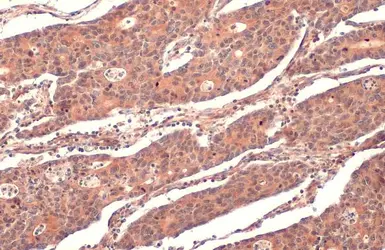 Anti-RRM1 antibody used in IHC (Paraffin sections) (IHC-P). GTX100758