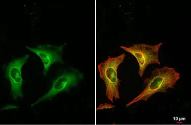 Anti-RRM1 antibody used in Immunocytochemistry/ Immunofluorescence (ICC/IF). GTX100758