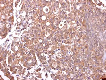 Anti-Mucin 4 antibody used in IHC (Paraffin sections) (IHC-P). GTX100775