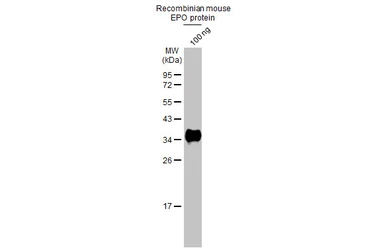 Anti-EPO antibody used in Western Blot (WB). GTX100813