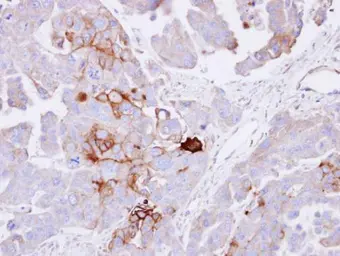Anti-Alkaline Phosphatase (Tissue Non-Specific) antibody used in IHC (Paraffin sections) (IHC-P). GTX100817