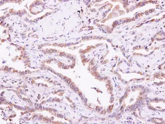 Anti-CIB1 antibody used in IHC (Paraffin sections) (IHC-P). GTX100849