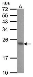 Anti-CIB1 antibody used in Western Blot (WB). GTX100849