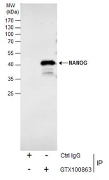 Anti-Nanog antibody [N3C3] used in Immunoprecipitation (IP). GTX100863