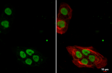 Anti-Nanog antibody [N3C3] used in Immunocytochemistry/ Immunofluorescence (ICC/IF). GTX100863