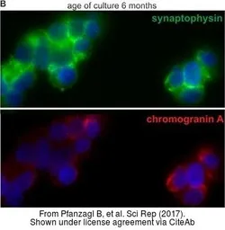 Anti-Synaptophysin antibody used in Immunocytochemistry/ Immunofluorescence (ICC/IF). GTX100865