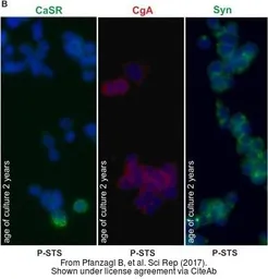 Anti-Synaptophysin antibody used in Immunocytochemistry/ Immunofluorescence (ICC/IF). GTX100865