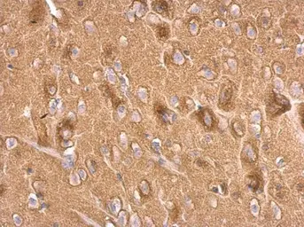 Anti-Synaptophysin antibody used in IHC (Paraffin sections) (IHC-P). GTX100865