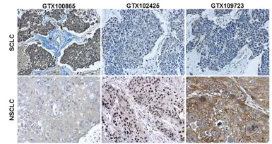 Anti-Synaptophysin antibody used in IHC (Paraffin sections) (IHC-P). GTX100865