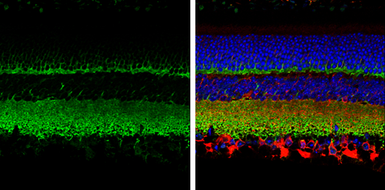 Anti-Synaptophysin antibody used in IHC (Paraffin sections) (IHC-P). GTX100865