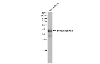 Anti-Synaptophysin antibody used in Western Blot (WB). GTX100865