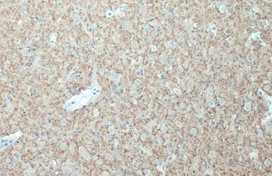 Anti-Synaptophysin antibody used in IHC (Paraffin sections) (IHC-P). GTX100865