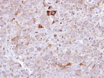 Anti-Synaptophysin antibody used in IHC (Paraffin sections) (IHC-P). GTX100865