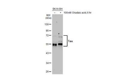 Anti-Tau antibody used in Western Blot (WB). GTX100866