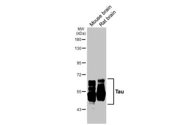 Anti-Tau antibody used in Western Blot (WB). GTX100866